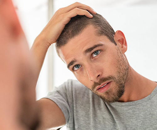 8 Best Haircuts for a Receding Hairline